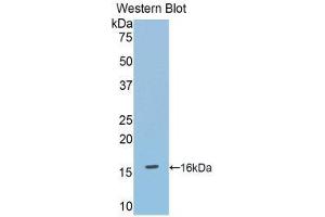 Image no. 1 for anti-Debranching Enzyme Homolog 1 (DBR1) (AA 133-241) antibody (ABIN1858612)