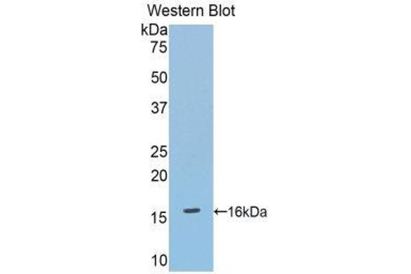 anti-Debranching Enzyme Homolog 1 (DBR1) (AA 133-241) antibody