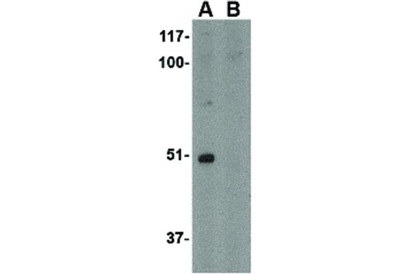 FNBP1L 抗体  (C-Term)