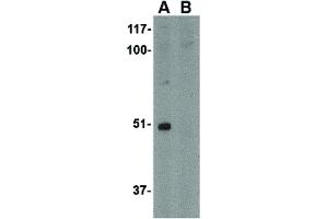 Image no. 1 for anti-Formin Binding Protein 1-Like (FNBP1L) (C-Term) antibody (ABIN6656712)