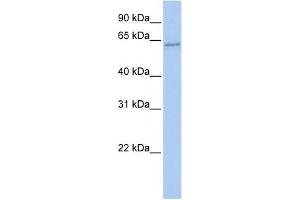 Human 293T; WB Suggested Anti-TFCP2 Antibody Titration: 0.