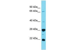 Image no. 1 for anti-HAUS Augmin-Like Complex, Subunit 2 (HAUS2) (N-Term) antibody (ABIN2791572)
