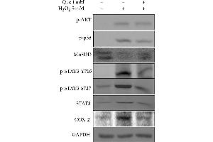 Image no. 14 for anti-Glyceraldehyde-3-Phosphate Dehydrogenase (GAPDH) (Center) antibody (ABIN2857072)