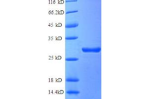 Image no. 1 for Adrenergic, Beta, Receptor Kinase 1 (ADRBK1) (AA 2-634), (partial) protein (His tag) (ABIN5712097)