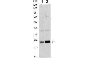 Image no. 2 for anti-RAB10, Member RAS Oncogene Family (RAB10) antibody (ABIN969376)