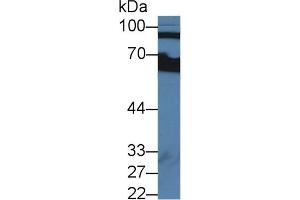 Image no. 2 for anti-Complement Factor B (CFB) (AA 35-160) antibody (ABIN1858372)