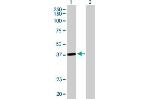 LRRC39 anticorps  (AA 1-335)