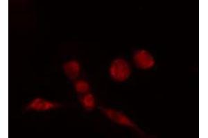 Image no. 1 for anti-Activating Transcription Factor 7 (AFT7) (N-Term) antibody (ABIN6256915)