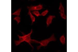 MALT1 antibody  (Internal Region)