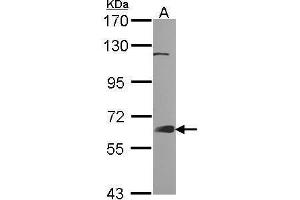WB Image Sample (30 ug of whole cell lysate) A: A431 , 7.