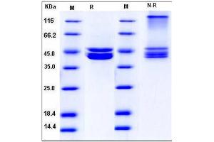 Image no. 1 for Protein Arginine Methyltransferase 6 (PRMT6) (AA 1-375) protein (DYKDDDDK Tag,His tag) (ABIN2004214)