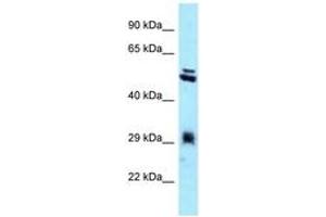 Image no. 1 for anti-Thioredoxin-Related Transmembrane Protein 1 (TMX1) (C-Term) antibody (ABIN6747965)