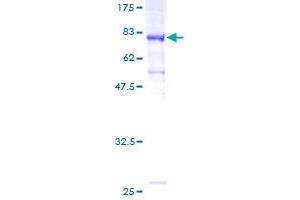 Image no. 1 for Myotubularin Related Protein 14 (MTMR14) (AA 1-417) protein (GST tag) (ABIN1311584)