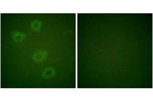 Immunofluorescence analysis of HuvEc cells, using Tyrosine Hydroxylase (Phospho-Ser19) Antibody.