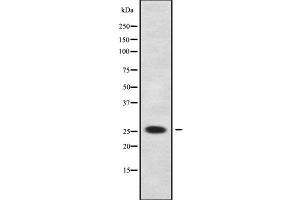 anti-Transcription Elongation Factor A (SII)-Like 2 (TCEAL2) antibody