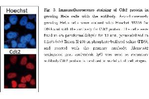 Image no. 4 for anti-Denticleless E3 Ubiquitin Protein Ligase Homolog (DTL) (C-Term) antibody (ABIN2451940)