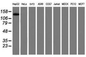 Image no. 4 for anti-PTK7 Protein tyrosine Kinase 7 (PTK7) antibody (ABIN1497127)