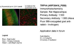 Image no. 2 for anti-Transient Receptor Potential Cation Channel, Subfamily V, Member 4 (TRPV4) (Middle Region) antibody (ABIN2776284)