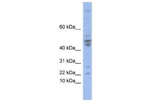 Image no. 1 for anti-Polymerase (DNA-Directed), epsilon 4 (p12 Subunit) (POLE4) (N-Term) antibody (ABIN2781088)