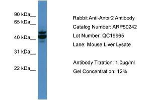 Image no. 2 for anti-Anthrax Toxin Receptor 2 (ANTXR2) (N-Term) antibody (ABIN2784112)