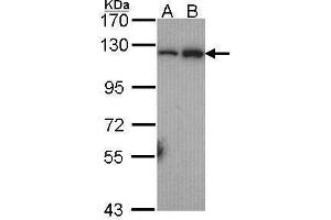 Image no. 4 for anti-Nuclear Factor of kappa Light Polypeptide Gene Enhancer in B-Cells 2 (NFKB2) (C-Term) antibody (ABIN2854310)