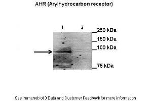Image no. 3 for anti-Aryl Hydrocarbon Receptor (AHR) (N-Term) antibody (ABIN2777386)