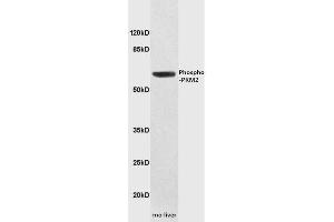 Image no. 2 for anti-Pyruvate Kinase M2 (PKM2) (pTyr105) antibody (ABIN744773)