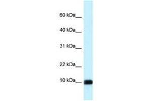 Image no. 1 for anti-Calmodulin Like Protein 3 (CALML3) (AA 63-112) antibody (ABIN6747652)