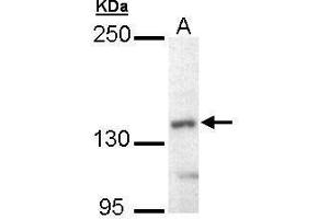 Image no. 3 for anti-Ubiquitin Conjugation Factor E4 B (UBE4B) (C-Term) antibody (ABIN2856674)