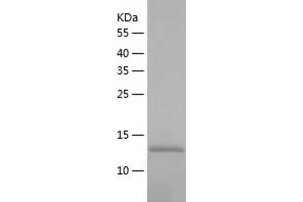 BATF Protein (AA 1-125) (His tag)