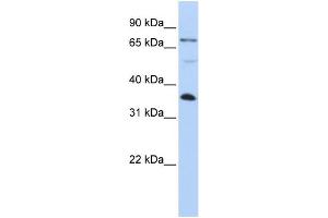 Image no. 1 for anti-LIM and SH3 Protein 1 (LASP1) (C-Term) antibody (ABIN2785891)