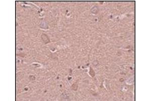 Image no. 1 for anti-Sushi-Repeat Containing Protein, X-Linked (SRPX) (N-Term) antibody (ABIN500807)
