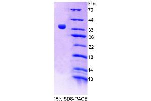 Image no. 1 for 3'(2'), 5'-Bisphosphate Nucleotidase 1 (BPNT1) (AA 2-308) protein (His tag) (ABIN6239518)