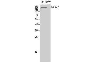 Image no. 1 for anti-Collagen, Type IV, alpha 2 (COL4A2) (N-Term) antibody (ABIN3184013)