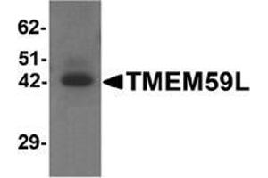 Image no. 2 for anti-Transmembrane Protein 59-Like (TMEM59L) (C-Term) antibody (ABIN1450042)