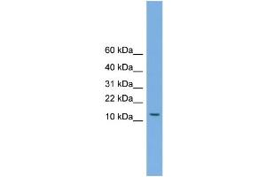 Image no. 1 for anti-Melanoma Antigen Family A, 5 (MAGEA5) (N-Term) antibody (ABIN2782572)