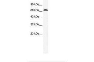 Image no. 2 for anti-Influenza Virus NS1A Binding Protein (IVNS1ABP) (AA 47-96) antibody (ABIN6735955)