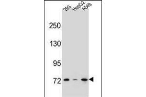 ZNF569 抗体  (N-Term)