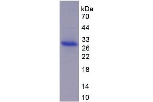 Image no. 2 for ADAM Metallopeptidase Domain 17 (ADAM17) ELISA Kit (ABIN6730919)