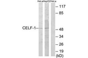 Image no. 1 for anti-CUGBP, Elav-Like Family Member 1 (CELF1) (AA 71-120) antibody (ABIN1534046)