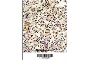 Image no. 2 for anti-Pericentriolar Material 1 (PCM1) (C-Term) antibody (ABIN2492469)
