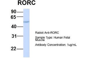 Image no. 3 for anti-RAR-Related Orphan Receptor C (RORC) (Middle Region) antibody (ABIN2777822)