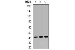Image no. 3 for anti-Mitochondrial Ribosomal Protein S22 (MRPS22) antibody (ABIN2801277)