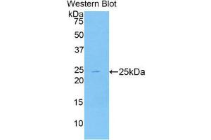 anti-Aminopeptidase Puromycin Sensitive (NPEPPS) (AA 584-755) antibody