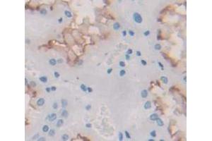 Image no. 2 for anti-Interleukin 12 Receptor beta 1 (IL12RB1) (AA 429-603) antibody (ABIN1859335)