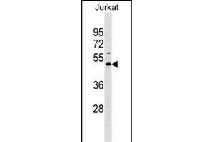 EAF1 Antibody (Center) (ABIN1538506 and ABIN2850095) western blot analysis in Jurkat cell line lysates (35 μg/lane).