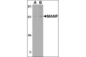Image no. 2 for anti-Mesencephalic Astrocyte-Derived Neurotrophic Factor (MANF) (N-Term) antibody (ABIN500226)