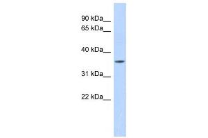 Image no. 1 for anti-Matrix Metallopeptidase 23B (MMP23B) antibody (ABIN2459052)