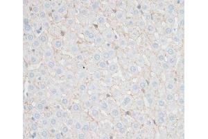 Immunohistochemistry of paraffin-embedded Rat liver using N-Cadherin Polyclonal Antibody at dilution of 1:100 (40x lens).
