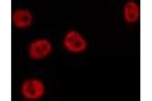 Image no. 2 for anti-Nuclear Factor (erythroid-Derived 2)-Like 3 (NFE2L3) (C-Term) antibody (ABIN6259125)
